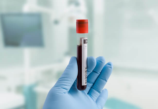 PRP Injections Pennsylvania